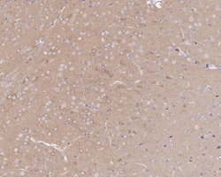 Invitrogen ROCK2 Recombinant Rabbit Monoclonal Antibody (JE31-36) 100 &mu;L;