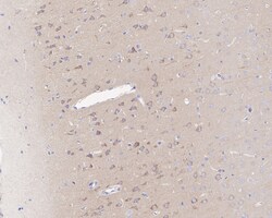 Invitrogen ROCK2 Recombinant Rabbit Monoclonal Antibody (JE31-36) 100 &mu;L;