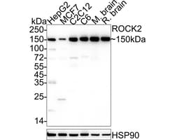 Invitrogen ROCK2 Recombinant Rabbit Monoclonal Antibody (JE31-36) 100 &mu;L;