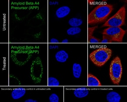 Invitrogen Amyloid Precursor Protein Recombinant Rabbit Monoclonal Antibody