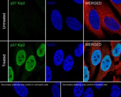 Invitrogen p57 Kip2 Recombinant Rabbit Monoclonal Antibody (JE02-08) 100