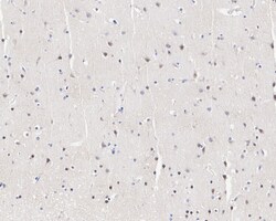 Invitrogen p57 Kip2 Recombinant Rabbit Monoclonal Antibody (JE02-08) 100