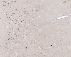 Invitrogen p57 Kip2 Recombinant Rabbit Monoclonal Antibody (JE02-08) 100