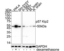 Invitrogen p57 Kip2 Recombinant Rabbit Monoclonal Antibody (JE02-08) 100