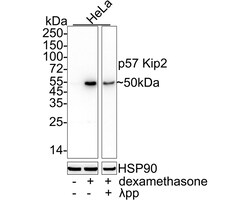 Invitrogen p57 Kip2 Recombinant Rabbit Monoclonal Antibody (JE02-08) 100