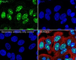 Invitrogen MNAR Recombinant Rabbit Monoclonal Antibody (JE02-42) 100 &mu;L;
