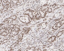 Invitrogen MNAR Recombinant Rabbit Monoclonal Antibody (JE02-42) 100 &mu;L;