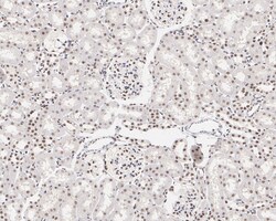 Invitrogen MNAR Recombinant Rabbit Monoclonal Antibody (JE02-42) 100 &mu;L;