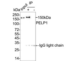 Invitrogen MNAR Recombinant Rabbit Monoclonal Antibody (JE02-42) 100 &mu;L;