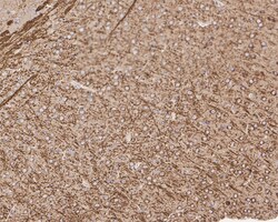 Invitrogen Amyloid Precursor Protein Recombinant Rabbit Monoclonal Antibody