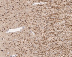 Invitrogen Amyloid Precursor Protein Recombinant Rabbit Monoclonal Antibody