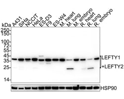 Invitrogen Lefty1/Lefty2 Recombinant Rabbit Monoclonal Antibody (JE38-88)