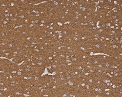 Invitrogen PMCA1 ATPase Recombinant Rabbit Monoclonal Antibody (JE34-05)