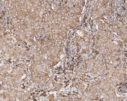 Invitrogen GRP78 Recombinant Rabbit Monoclonal Antibody (JE01-35) 100 &mu;L;