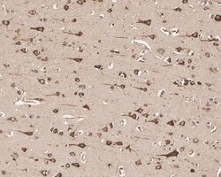 Invitrogen GRP78 Recombinant Rabbit Monoclonal Antibody (JE01-35) 100 &mu;L;