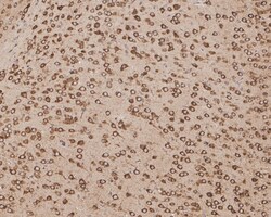 Invitrogen GRP78 Recombinant Rabbit Monoclonal Antibody (JE01-35) 100 &mu;L;