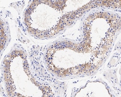 Invitrogen LRP8 Recombinant Rabbit Monoclonal Antibody (JE31-73) 100 &mu;L;