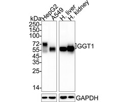 Invitrogen GGT1 Recombinant Rabbit Monoclonal Antibody (JE38-79) 100 &mu;L;
