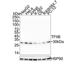 Invitrogen GTF2B Recombinant Rabbit Monoclonal Antibody (JE38-37) 100 &mu;L;