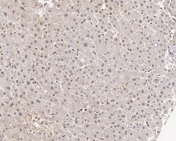 Invitrogen RAD23A Recombinant Rabbit Monoclonal Antibody (JE38-49) 100 &mu;L | Buy Online | Invitrogen&trade; | Fisher Scientific