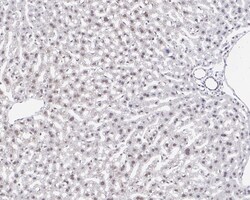 Invitrogen RAD23A Recombinant Rabbit Monoclonal Antibody (JE38-49) 100 &mu;L | Buy Online | Invitrogen&trade; | Fisher Scientific