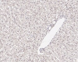 Invitrogen RAD23A Recombinant Rabbit Monoclonal Antibody (JE38-49) 100 &mu;L | Buy Online | Invitrogen&trade; | Fisher Scientific