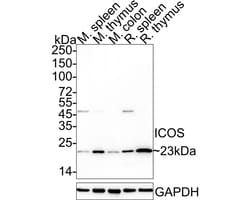 Invitrogen ICOS (CD278) Recombinant Rabbit Monoclonal Antibody (JE39-99)