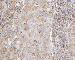 Invitrogen TUBB1 Recombinant Rabbit Monoclonal Antibody (JE01-23) 100 &mu;L;