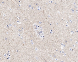 Invitrogen TUBB1 Recombinant Rabbit Monoclonal Antibody (JE01-23) 100 &mu;L;