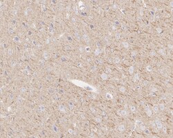 Invitrogen TUBB1 Recombinant Rabbit Monoclonal Antibody (JE01-23) 100 &mu;L;