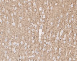 Invitrogen TUBB1 Recombinant Rabbit Monoclonal Antibody (JE01-23) 100 &mu;L;