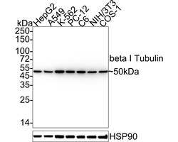 Invitrogen TUBB1 Recombinant Rabbit Monoclonal Antibody (JE01-23) 100 &mu;L;