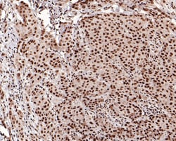 Invitrogen CBP Recombinant Rabbit Monoclonal Antibody (PS01-16) 100 &mu;L;