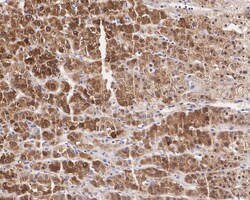 Invitrogen INHA Recombinant Rabbit Monoclonal Antibody (PD01-29) 100 &mu;L;