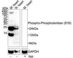 Invitrogen Phospho-Phospholamban (Ser16) Recombinant Rabbit Monoclonal