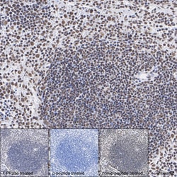 Invitrogen Phospho-AKT1/AKT2/AKT3 (Ser473) Recombinant Rabbit Monoclonal