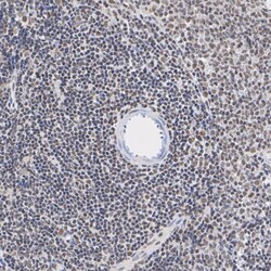 Invitrogen Phospho-AKT1/AKT2/AKT3 (Ser473) Recombinant Rabbit Monoclonal