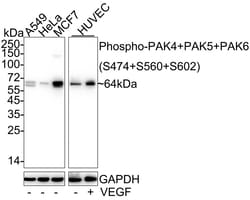 Invitrogen Phospho-PAK4/6/7 (Ser474, Ser602, Ser560) Recombinant Rabbit