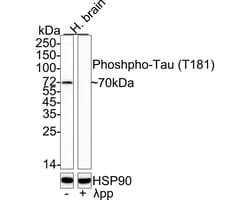 Invitrogen Phospho-Tau (Thr181) Recombinant Rabbit Monoclonal Antibody