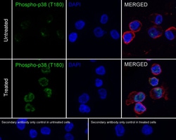 Invitrogen Phospho-p38 MAPK (Thr180) Recombinant Rabbit Monoclonal Antibody