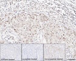 Invitrogen Phospho-p38 MAPK (Thr180) Recombinant Rabbit Monoclonal Antibody
