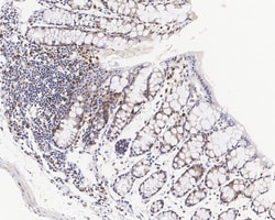 Invitrogen Phospho-p38 MAPK (Thr180) Recombinant Rabbit Monoclonal Antibody