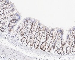 Invitrogen Phospho-p38 MAPK (Thr180) Recombinant Rabbit Monoclonal Antibody