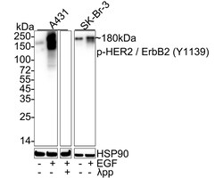 Invitrogen Phospho-ErbB2 (HER-2) (Tyr1139) Recombinant Rabbit Monoclonal