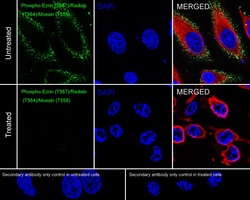 Invitrogen Phospho-Ezrin/Radixin/Moesin (Thr567, Thr564, Thr558) Recombinant