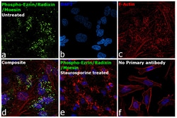 Invitrogen Phospho-Ezrin/Radixin/Moesin (Thr567, Thr564, Thr558) Recombinant