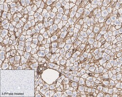 Invitrogen Phospho-Ezrin/Radixin/Moesin (Thr567, Thr564, Thr558) Recombinant