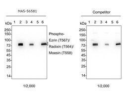 Invitrogen Phospho-Ezrin/Radixin/Moesin (Thr567, Thr564, Thr558) Recombinant