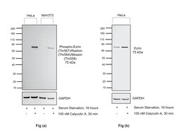 Invitrogen Phospho-Ezrin/Radixin/Moesin (Thr567, Thr564, Thr558) Recombinant