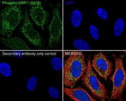 Phospho-DNM1L (Ser616) Recombinant Rabbit Monoclonal Antibody (PSH06-77):Antibodies,